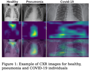 Fast COVID and Respiratory detection